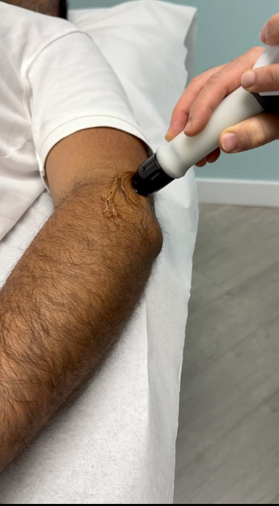 Shockwave Therapy